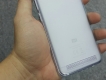 ốp lưng dẻo Xiaomi Redmi 5A