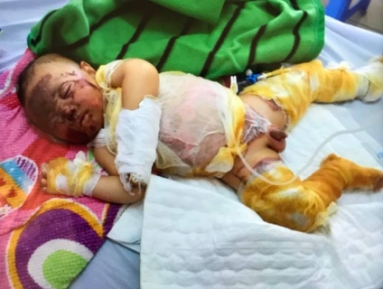 [Từ Thiện] Bé Bảo Khánh Bị Bỏng Toàn Thân