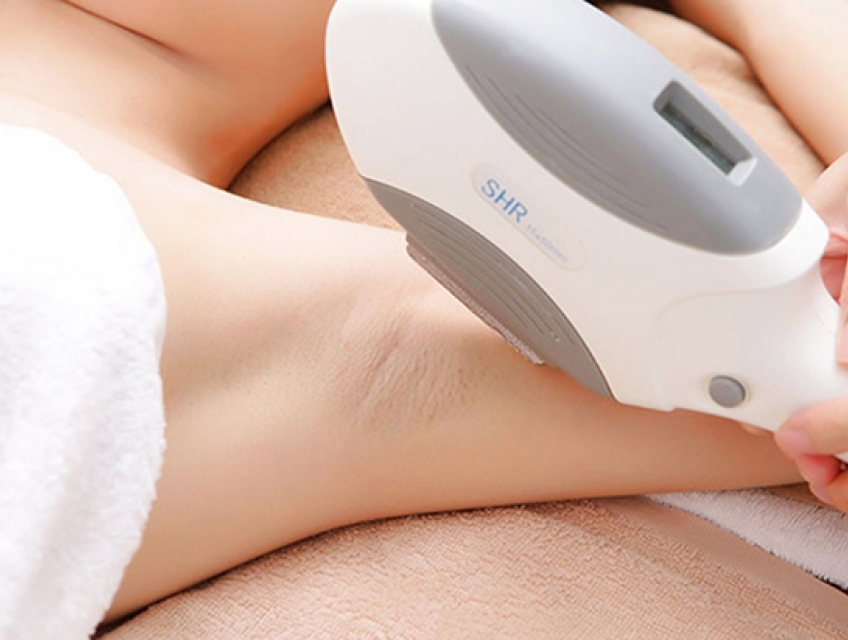 So Sánh Triệt Lông Nóng Và Lạnh