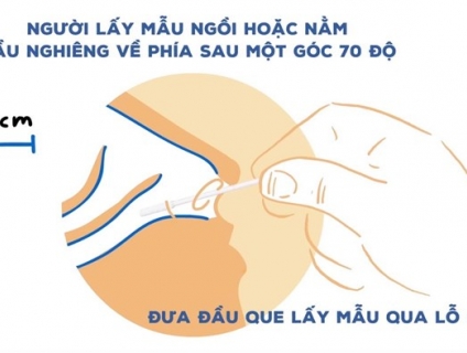 6 điều cần biết về vấn đề “Dương tính giả”