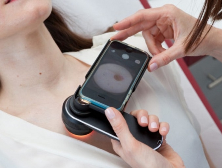 Ung thu da nguyen nhan dau hieu va bien chung ban nen biet