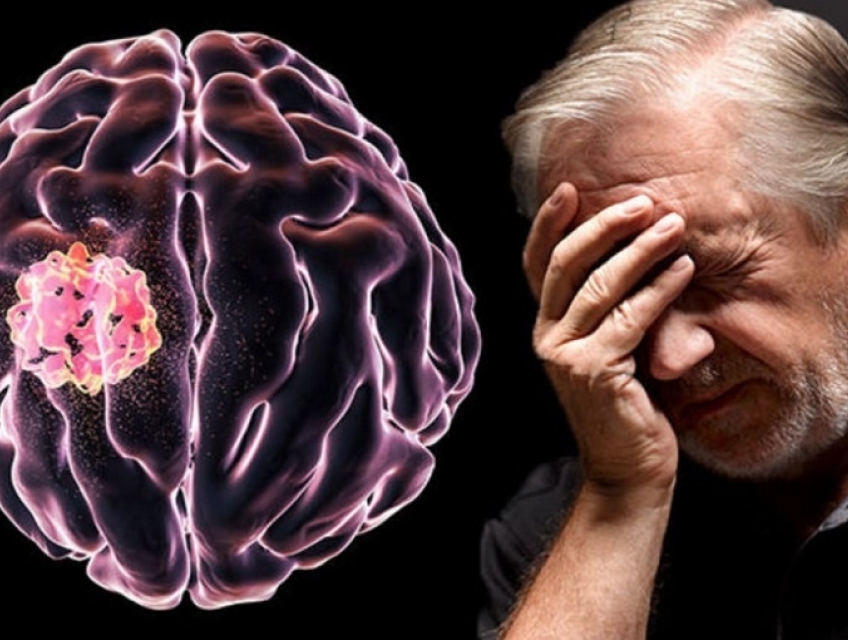 Nhung canh bao dau hieu ung thu nao