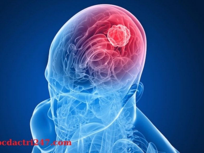 Benh Ung Thu Nao Nguyen Nhan va Chan Doan