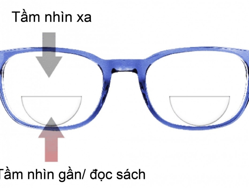 Tròng kính viễn thị – Giải pháp hiệu quả cho vấn đề viễn thị