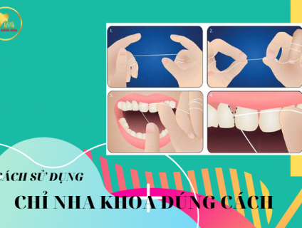HƯỚNG DẪN CÁCH DÙNG CHỈ NHA KHOA ĐÚNG CÁCH VÀ HIỆU QUẢ