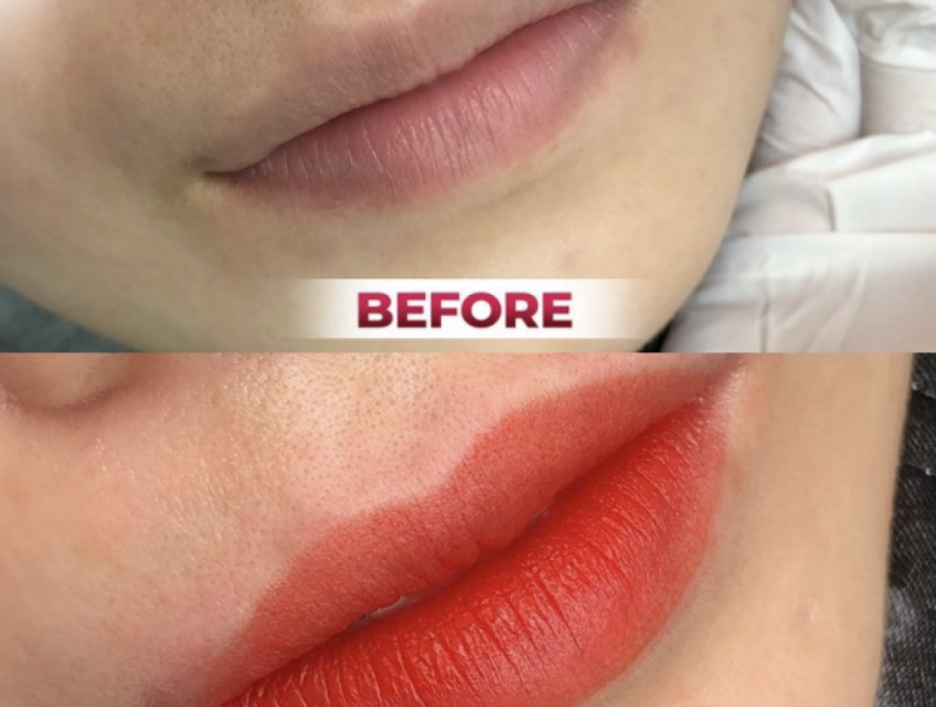 Môi Trên Thâm Môi Dưới Hồng: Nguyên Nhân và Cách Khắc Phục Hiệu Quả