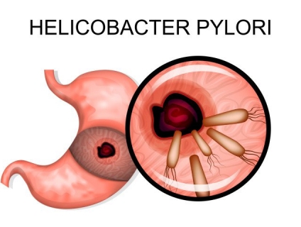 Vi khuẩn Hp có thể sống được bao lâu