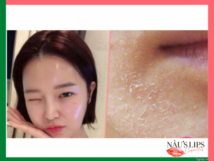 Có nên tẩy tế bào chết cho da mặt, sai lầm mà bạn đang “Tẩy chết da”