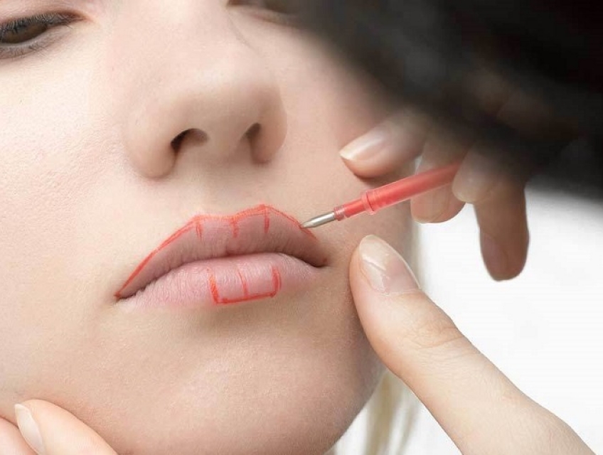 Dặm lại môi có đau không? Ưu và nhược điểm