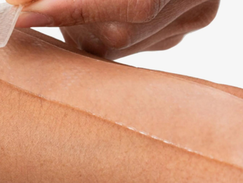 Vết sẹo bị ngứa tại sao? Cách trị sẹo ngứa hiệu quả
