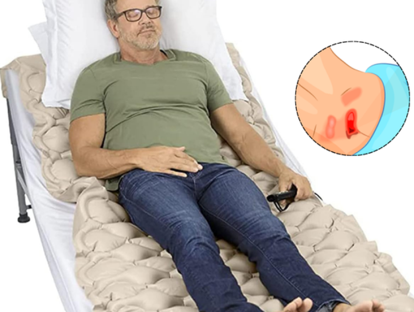 Cách chăm sóc vết loét vùng cùng cụt tại nhà