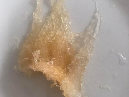 100gram yến cam đảo ngon , tổ to ít lông , già nhiều sợi