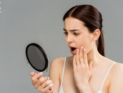 Lợi ích của matcha giúp kiểm soát mụn