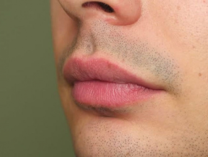 Khử Thâm Môi Nam Giới: Các Kỹ Thuật Massage Môi Để Tăng Cường Hiệu Quả