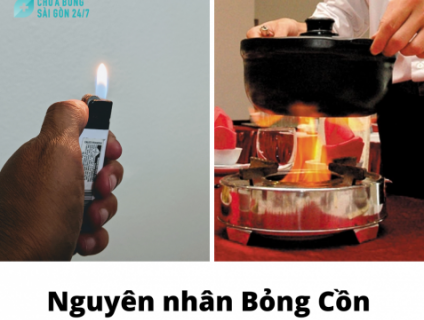 Bỏng Cồn nên làm gì?