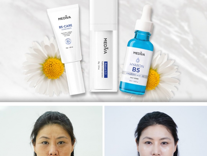 Khắc phục lão hóa da với bộ 3 siêu phẩm Mediva Retinol Rejuvenating