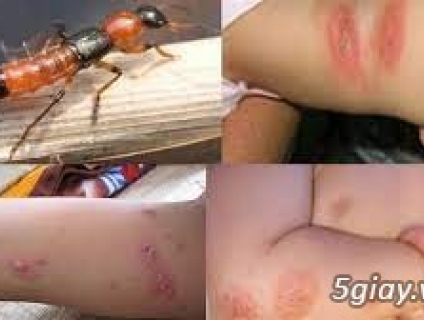 Dịch vụ diệt kiến ba khoang uy tín chất lượng 100%