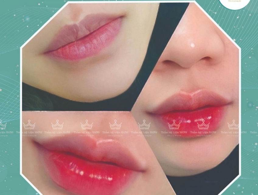 Phun môi 499k ưu đãi hậu 20/10