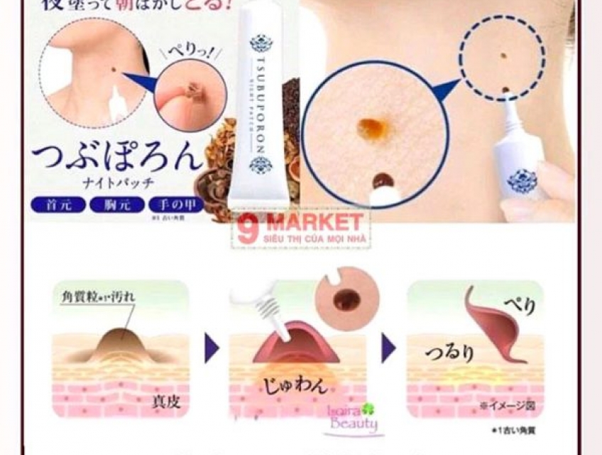 Kem tẩy nốt ruồi Tsubuporon Night Patch Nhật an toàn và hiệu quả