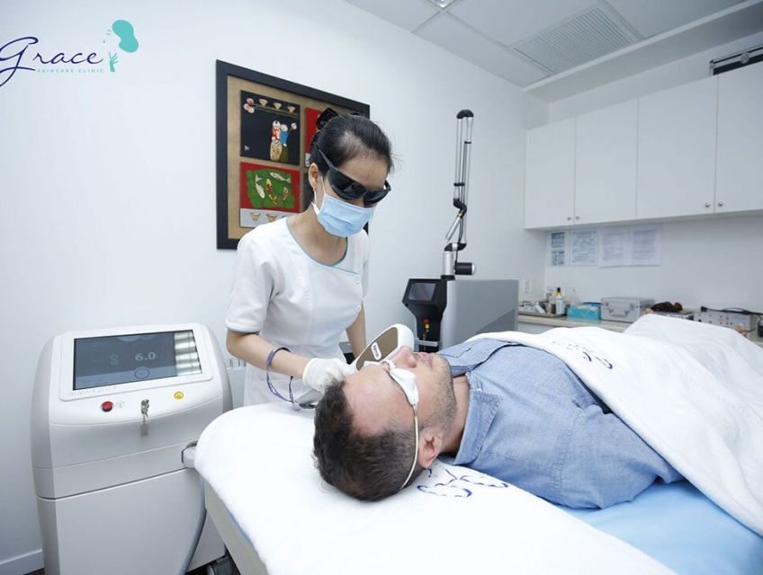 So sánh hiệu quả triệt râu quai nón bằng Laser, IPL và Ánh sáng thường