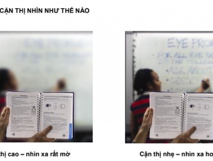 CÁCH KIỂM TRA MẮT CÓ MẮC TẬT KHÚC XẠ HAY KHÔNG