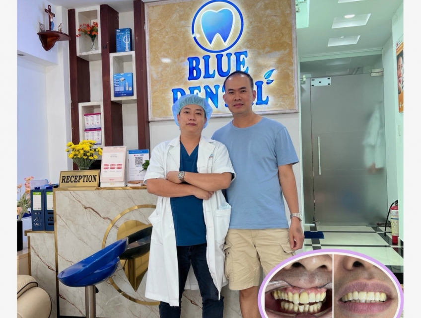 Địa chỉ làm răng uy tín tại quận Tân Bình? Nha khoa Blue dental