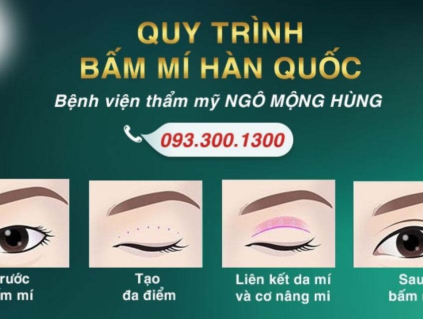 Bấm mí mắt kiểu Hàn Quốc có đẹp không?