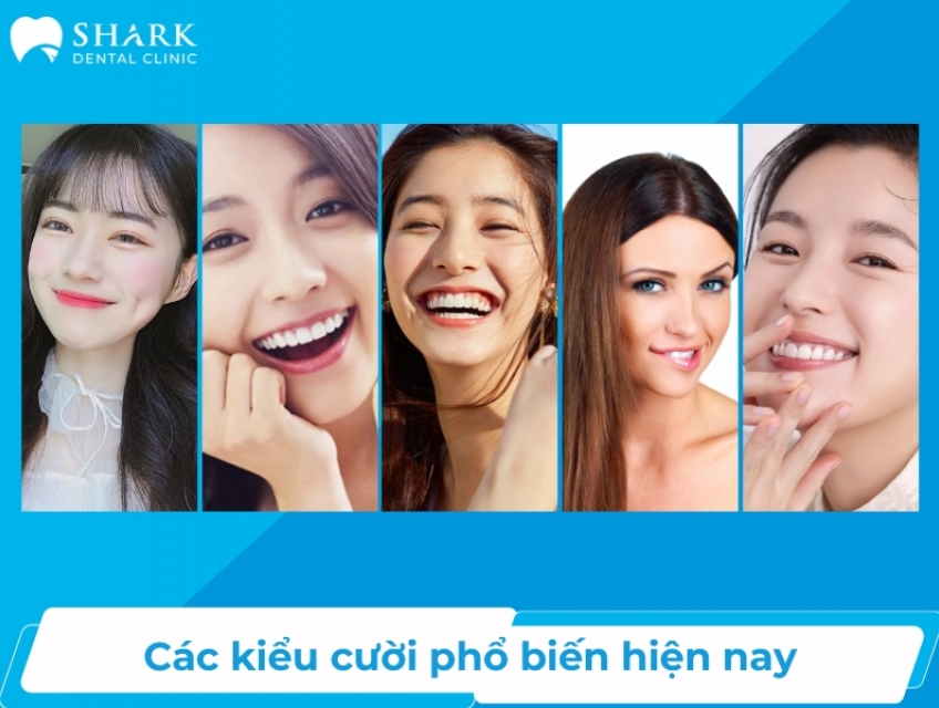 Các kiểu cười phổ biến và thông điệp chúng mang lại