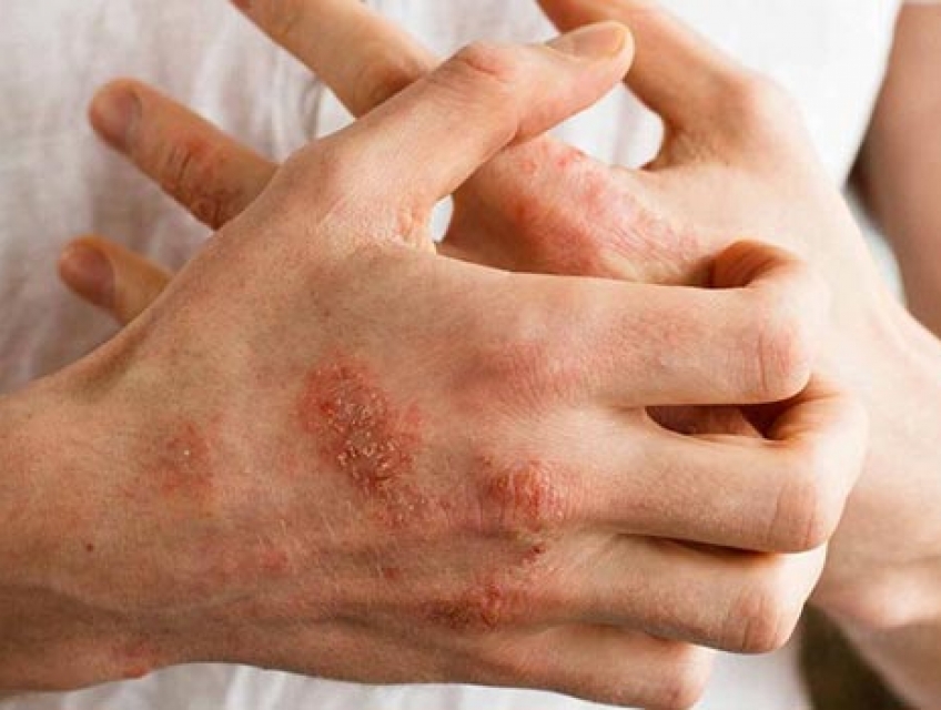 10 Phòng khám da liễu ở Quận 5 uy tín chất lượng