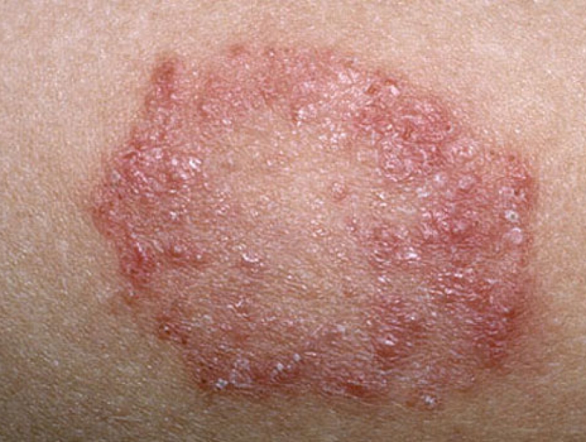 10 Phòng khám da liễu ở Tân Phú uy tín chất lượng